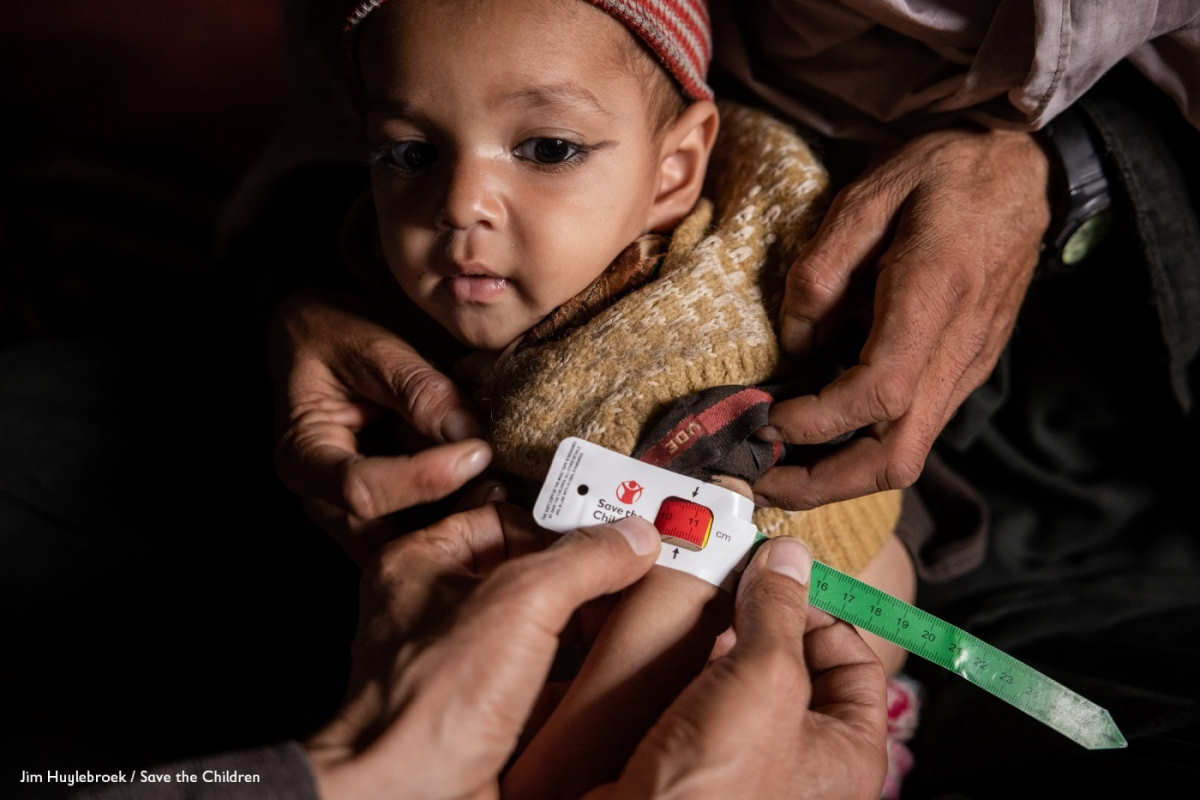 Save the Children, in Afghanistan i casi di malnutrizione infantile sono in aumento di quasi il 50%
