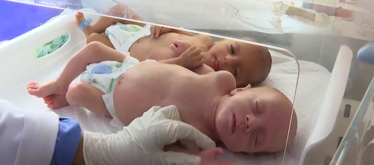 Ecco come i neonati muoiono a Gaza... oltre che per le bombe