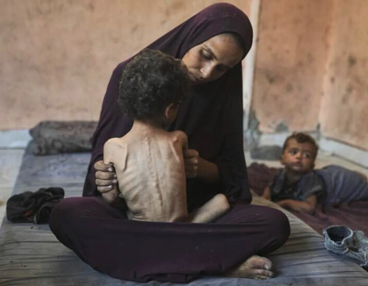 30 luglio: a Gaza alri sette morti per fame nelle ultime 24 ore